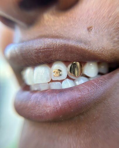 Tooth Gems By Diamond